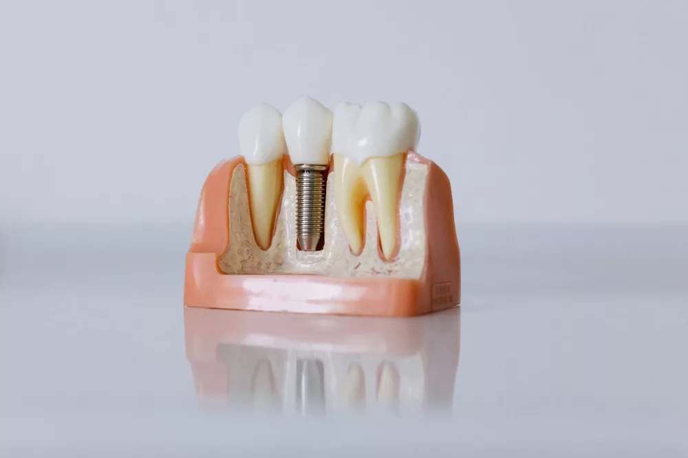 Unpacking the ClearChoice Dental Experience: A Detailed Look