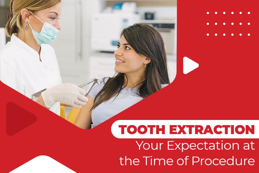 Tooth Extraction- Your Expectation at the Time of Procedure